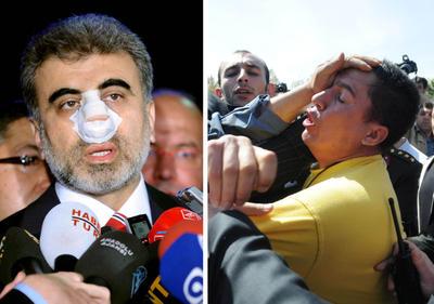 2010 - Bakan Taner Yıldıza Yumruk